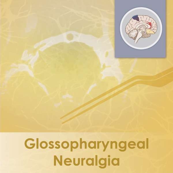 Glossopharyngeal Neuralgia – The Neurosurgical Atlas