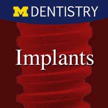 Implants – Single tooth – University of Michigan School of Dentistry