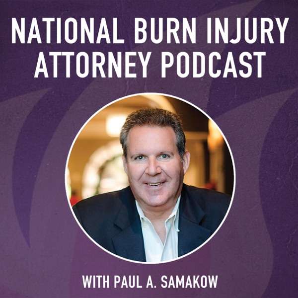 Samakow National Burn Injury Attorney Podcast