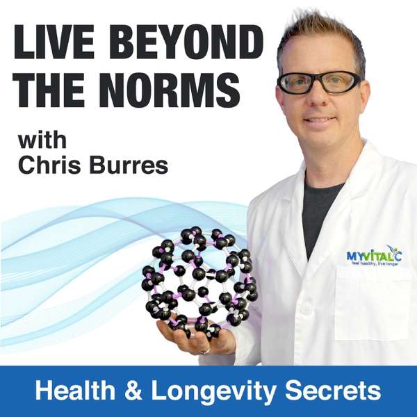 Live Beyond the Norms – Chris Burres